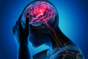 Ethnic Inequalities Persist in Stroke Care, Outcomes